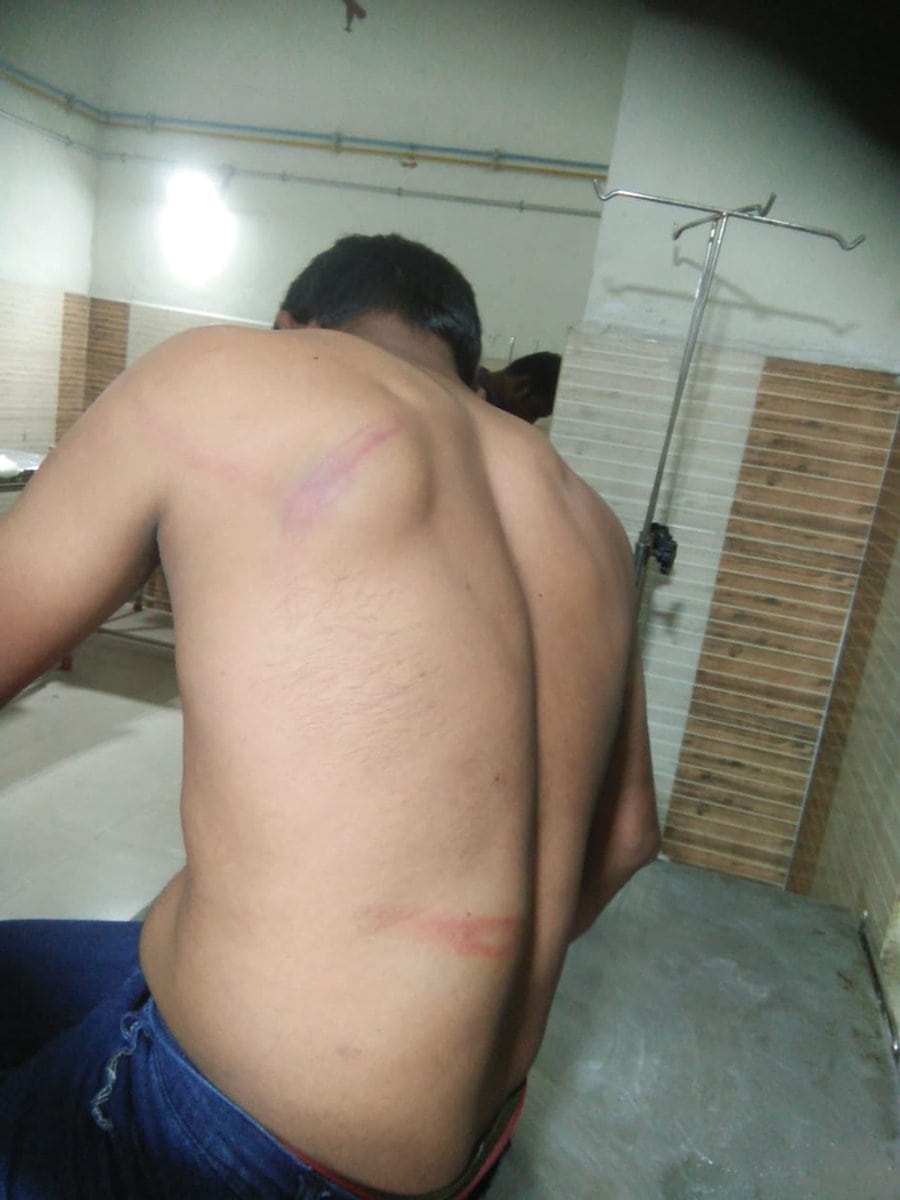 Photograph of injuries sustained by one the Christians, name unknown - Credit: Nehemiah Christie.
