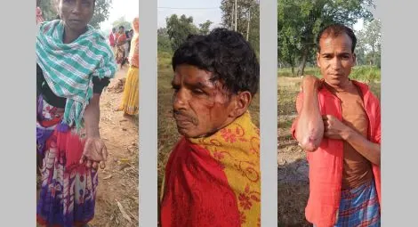 Some of the injuries sustained by members of the tribal community in Singawaram village. Credit: CSW