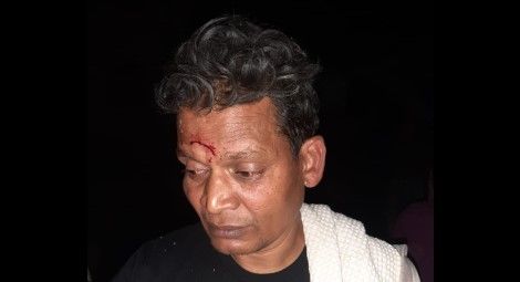 Pastor Rakesh Babu on the night of the attack