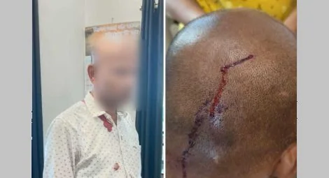 Pastor Varghese Chacko and the injury to his head.