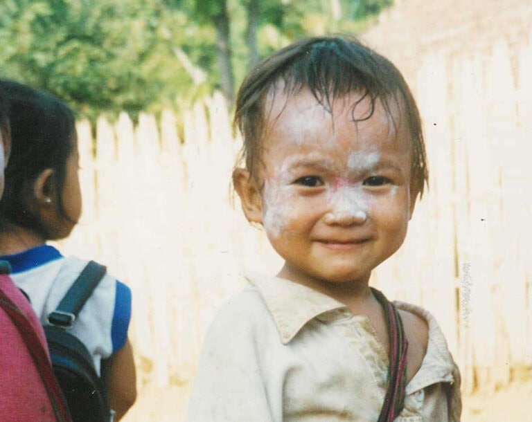 A Burmese refugee