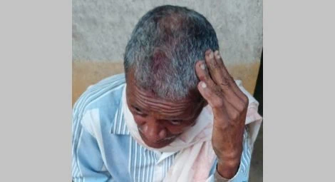 A Christian villager from Iradaha after the mob attack on 20 August.