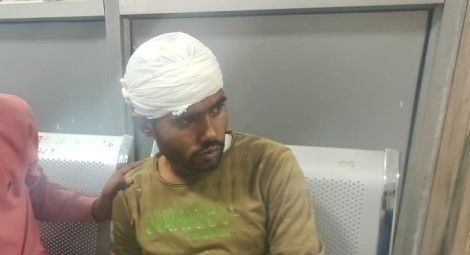 Saheb Ali Khan, pictured after receiving treatment in hospital